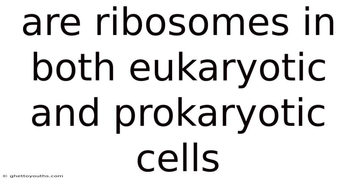 Are Ribosomes In Both Eukaryotic And Prokaryotic Cells