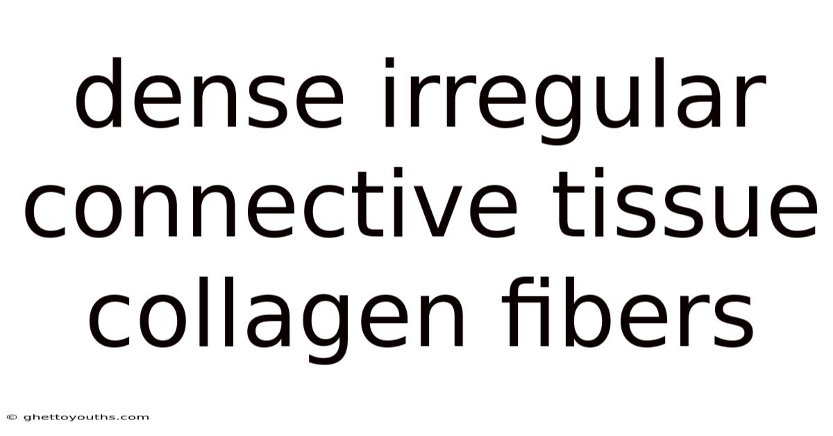 Dense Irregular Connective Tissue Collagen Fibers