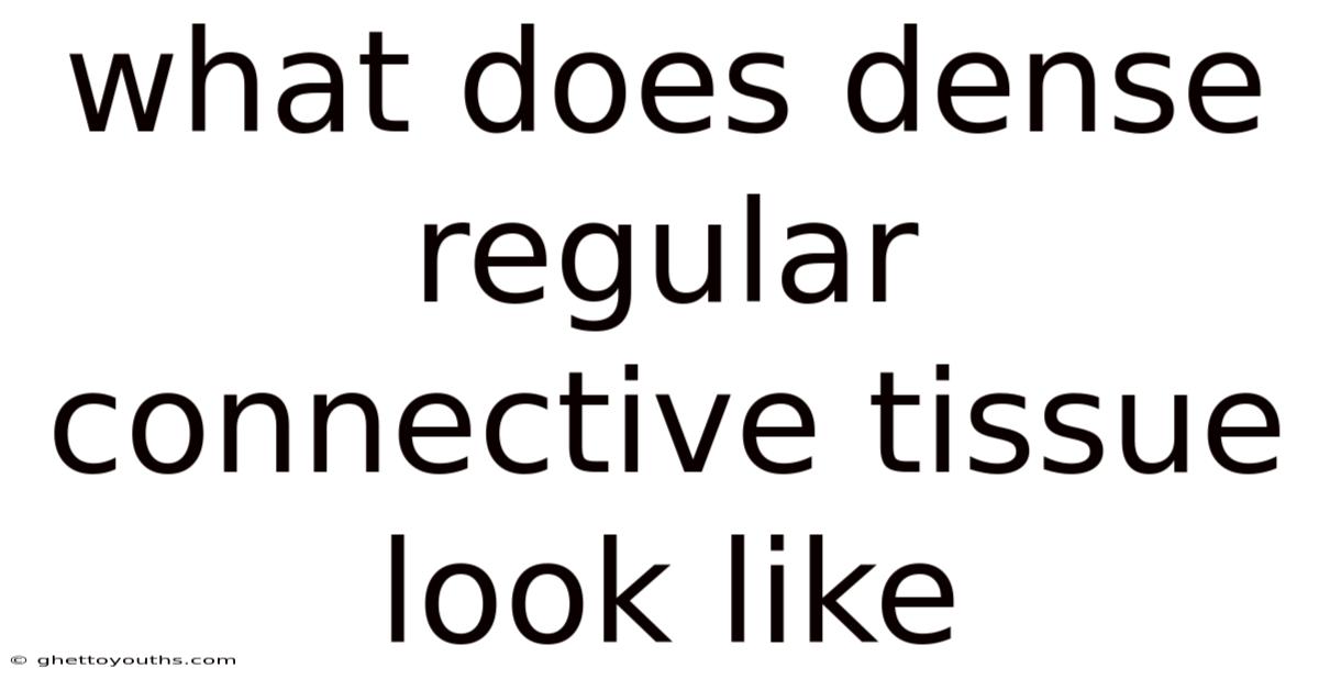 What Does Dense Regular Connective Tissue Look Like