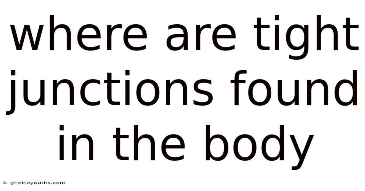 Where Are Tight Junctions Found In The Body